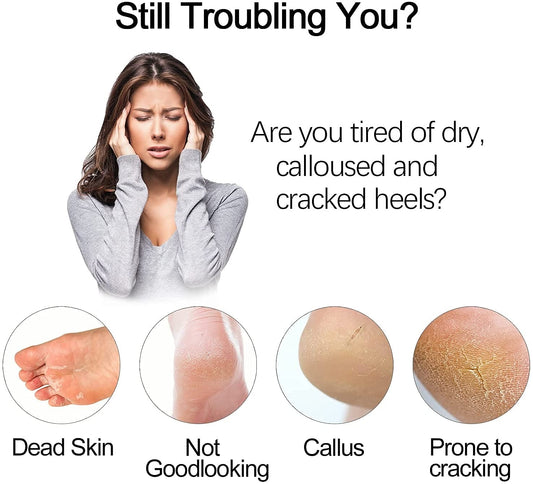 Electric Foot Grinder – Vacuum Foot Grinding Machine for Exfoliating Dead Skin, Callus Remover & Foot Care