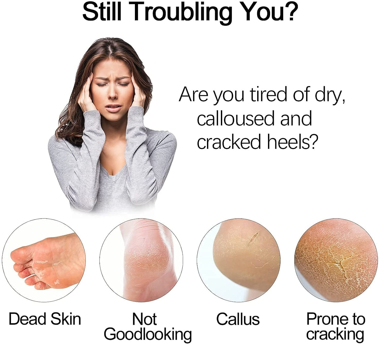 Electric Foot Grinder – Vacuum Foot Grinding Machine for Exfoliating Dead Skin, Callus Remover & Foot Care