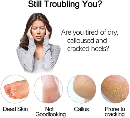 Electric Foot Grinder – Vacuum Foot Grinding Machine for Exfoliating Dead Skin, Callus Remover & Foot Care